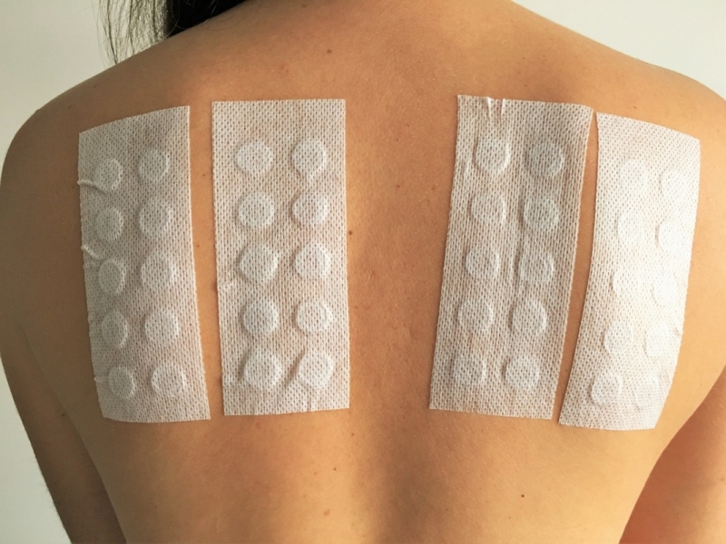 Patch test