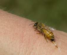 Alergia a picada de insetos